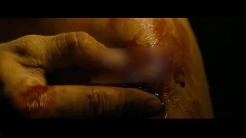 丝袜粘住伤口,揭秘背后的医疗隐患与应对策略